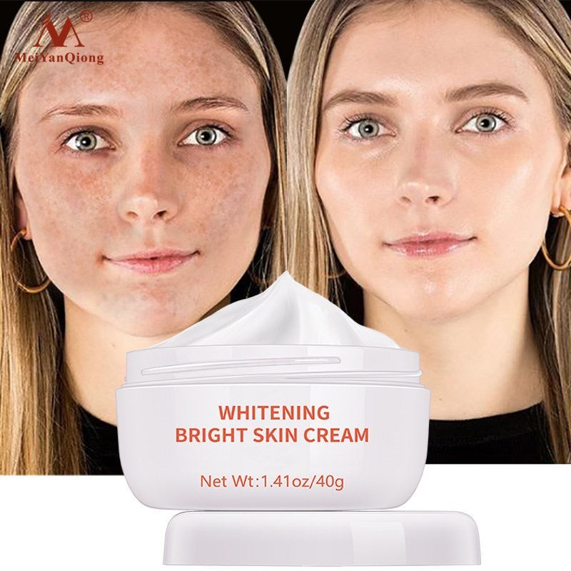 Powerful Whitening Freckle Cream Remove