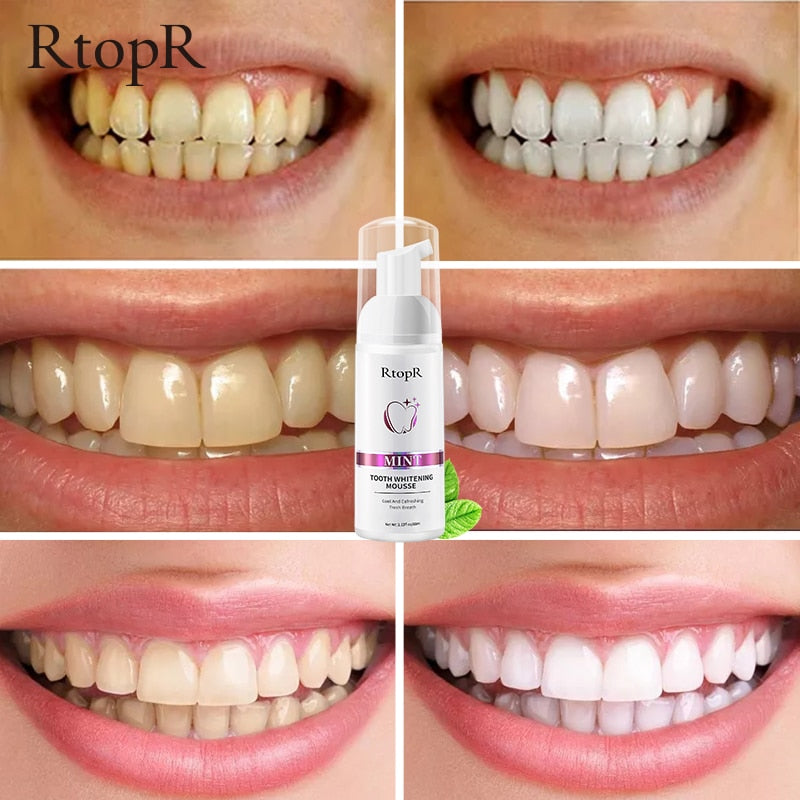 Tooth Whitening Mousse
