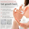 Minoxidil Women Hair Regrowth Treatment Foam