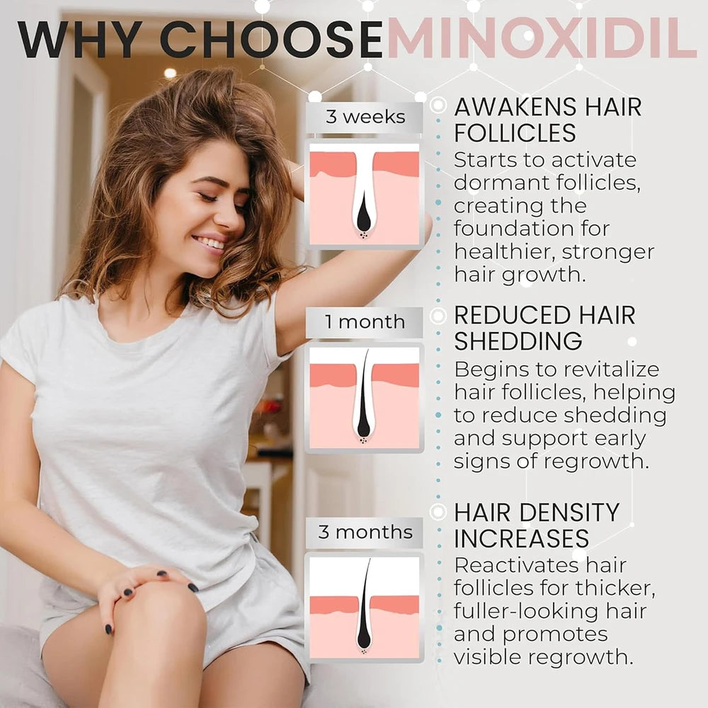 Minoxidil Women Hair Regrowth Treatment Foam