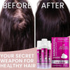 Minoxidil Women Hair Regrowth Treatment Foam